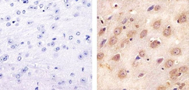 STAT3 Antibody in Immunohistochemistry (Paraffin) (IHC (P))