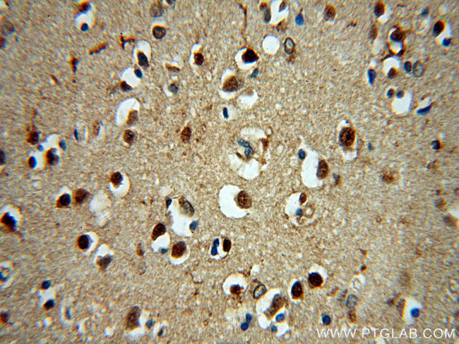 NPAS1 Antibody in Immunohistochemistry (Paraffin) (IHC (P))