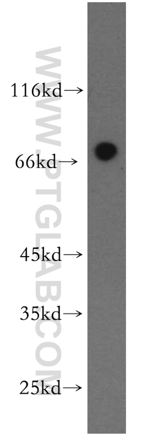 NPAS1 Antibody in Western Blot (WB)