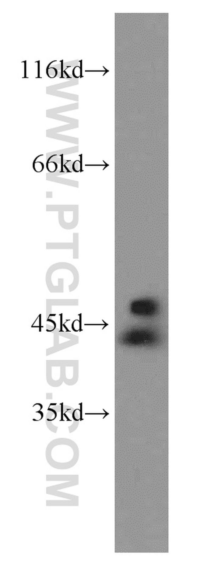 ADAP2 Antibody in Western Blot (WB)