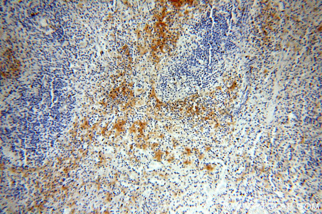 ADAP2 Antibody in Immunohistochemistry (Paraffin) (IHC (P))