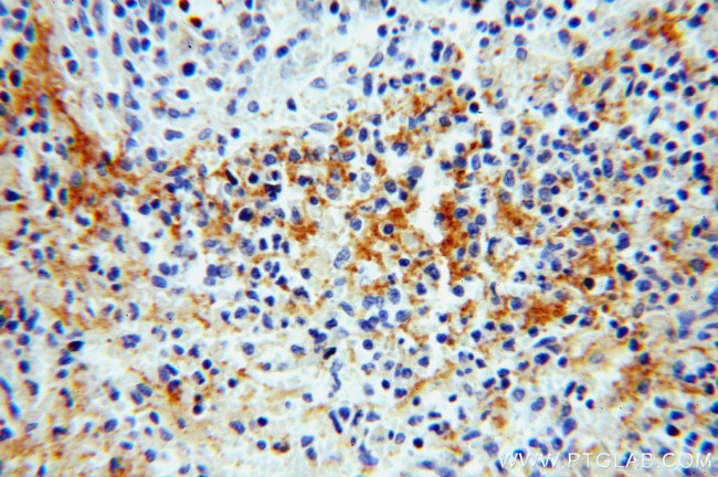 ADAP2 Antibody in Immunohistochemistry (Paraffin) (IHC (P))