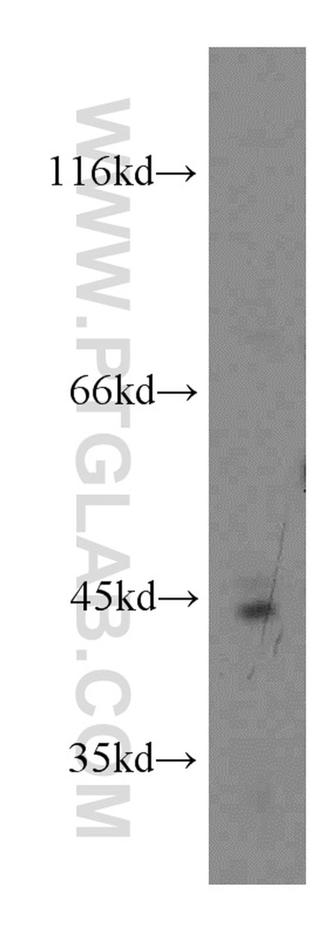 ADAP2 Antibody in Western Blot (WB)