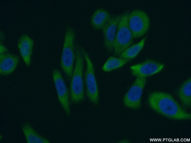 LARP1 Antibody in Immunocytochemistry (ICC/IF)