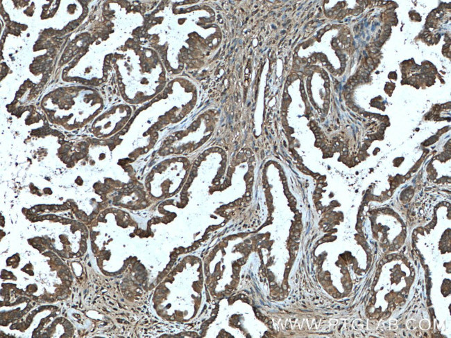 LARP1 Antibody in Immunohistochemistry (Paraffin) (IHC (P))