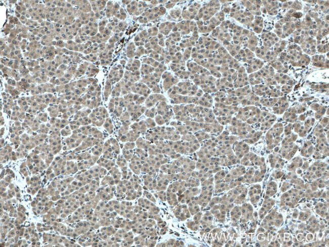 LARP1 Antibody in Immunohistochemistry (Paraffin) (IHC (P))