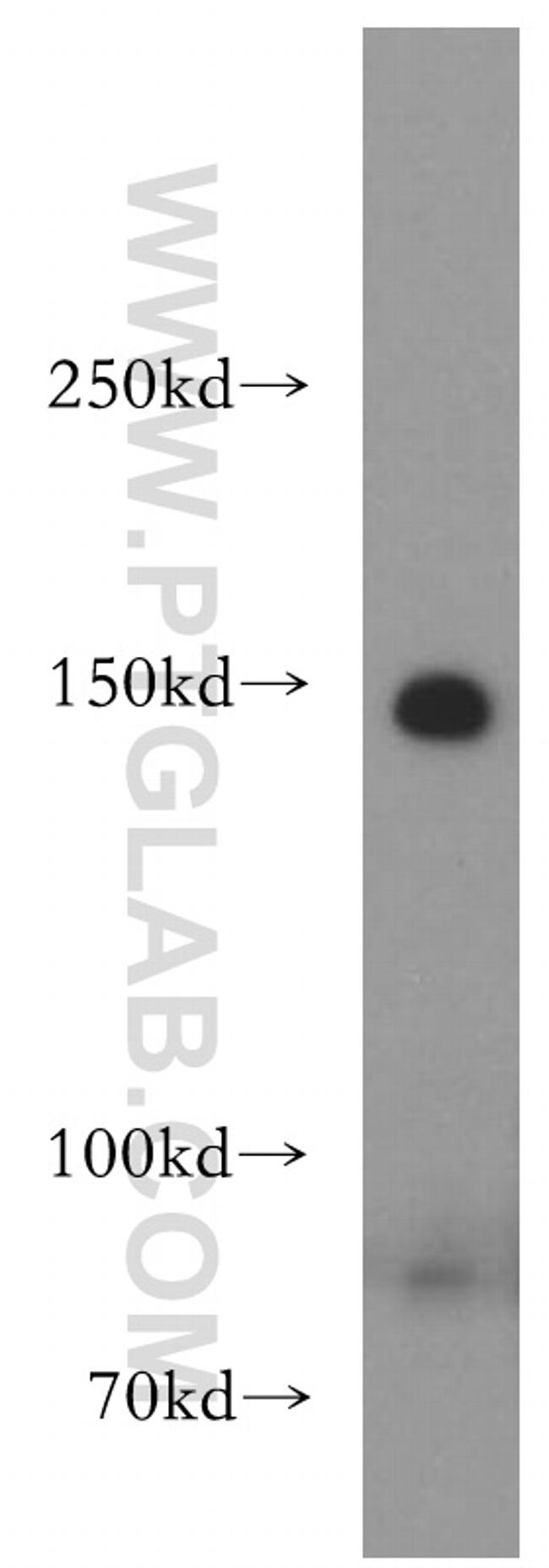 LARP1 Antibody in Western Blot (WB)