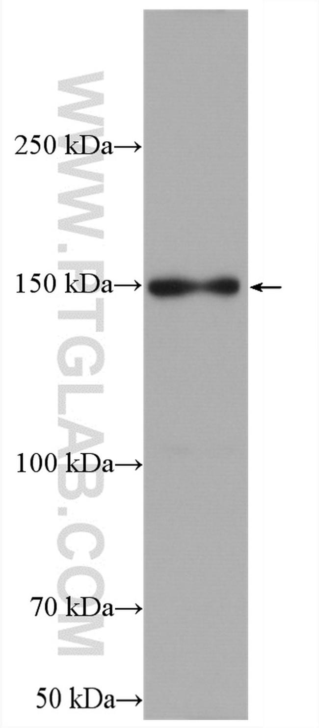 LARP1 Antibody in Western Blot (WB)