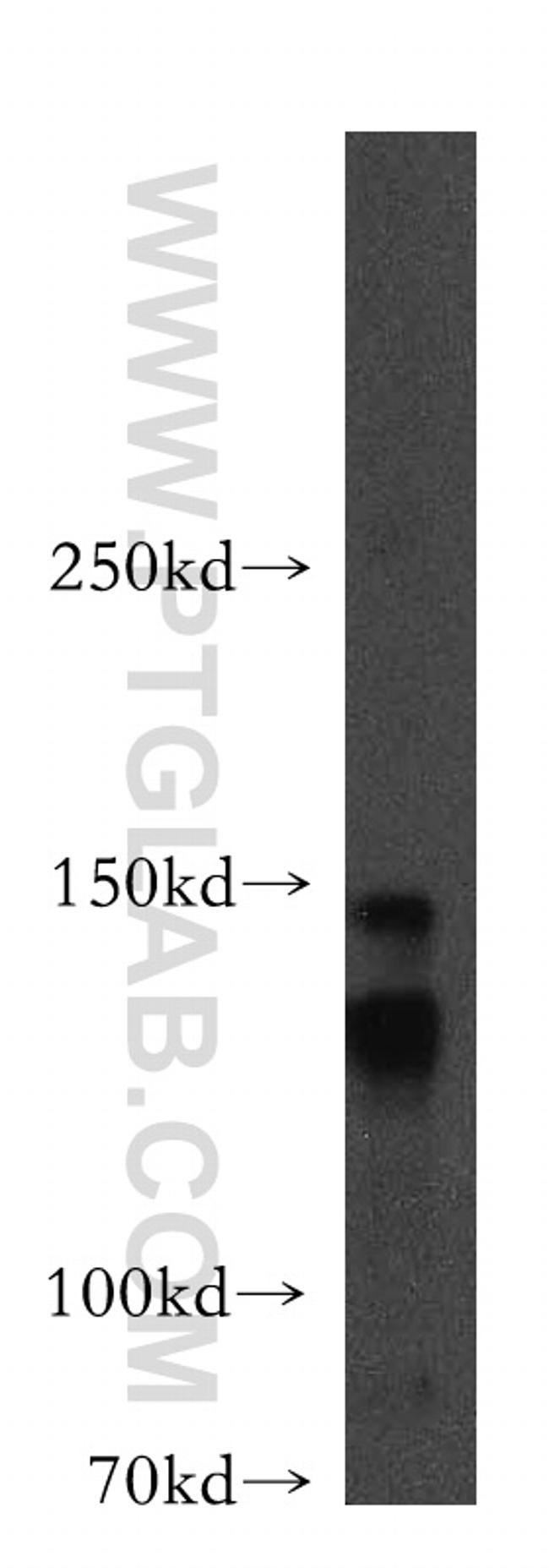 LARP1 Antibody in Western Blot (WB)