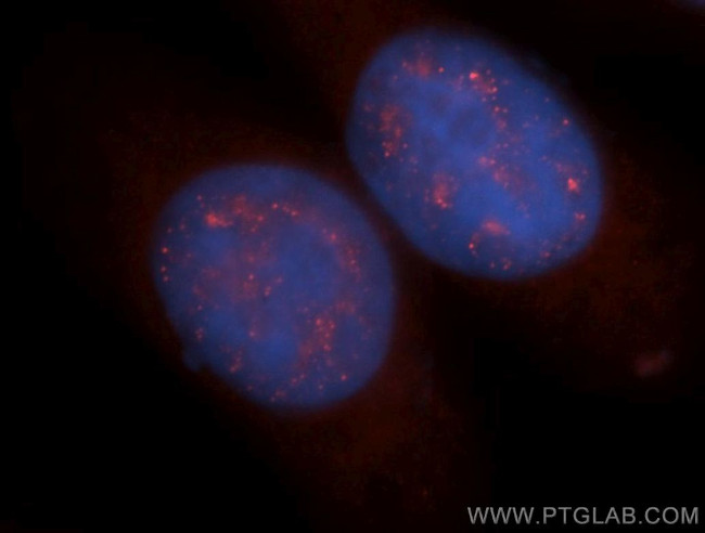 TCP10L Antibody in Immunocytochemistry (ICC/IF)