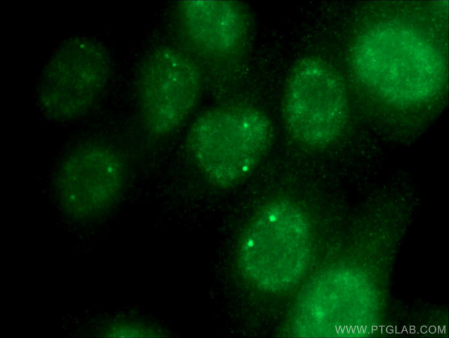 TCP10L Antibody in Immunocytochemistry (ICC/IF)