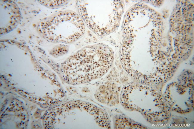 TCP10L Antibody in Immunohistochemistry (Paraffin) (IHC (P))