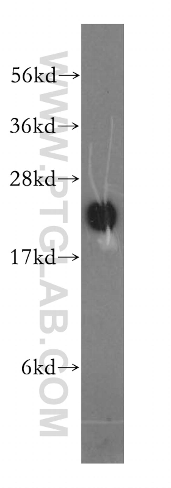 TCP10L Antibody in Western Blot (WB)