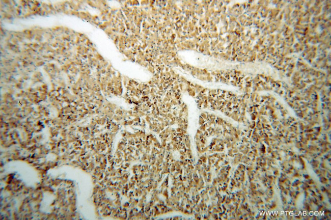 Carboxypeptidase E Antibody in Immunohistochemistry (Paraffin) (IHC (P))