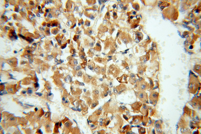 Carboxypeptidase E Antibody in Immunohistochemistry (Paraffin) (IHC (P))