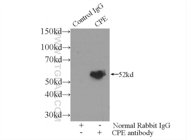 Carboxypeptidase E Antibody in Immunoprecipitation (IP)