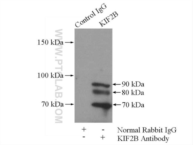 KIF2B Antibody in Immunoprecipitation (IP)