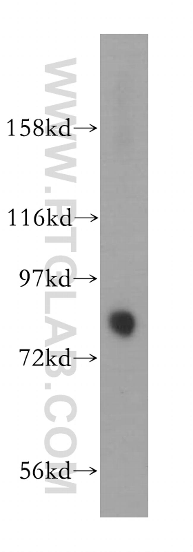 KIF2B Antibody in Western Blot (WB)