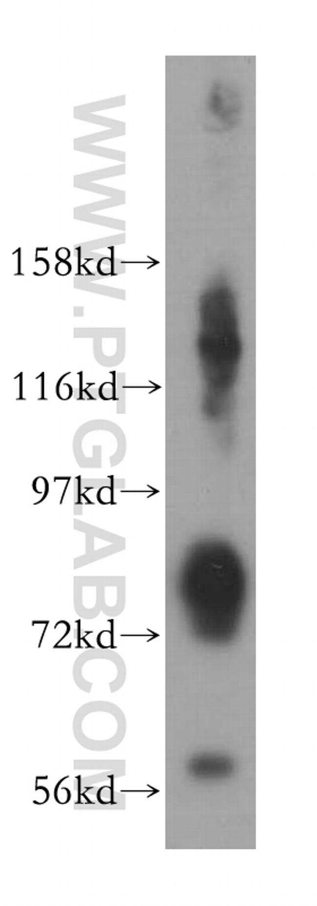 KIF2B Antibody in Western Blot (WB)