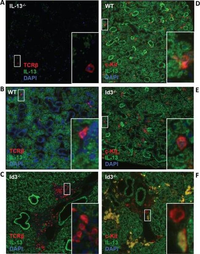 IL-13 Antibody in Immunohistochemistry (IHC)