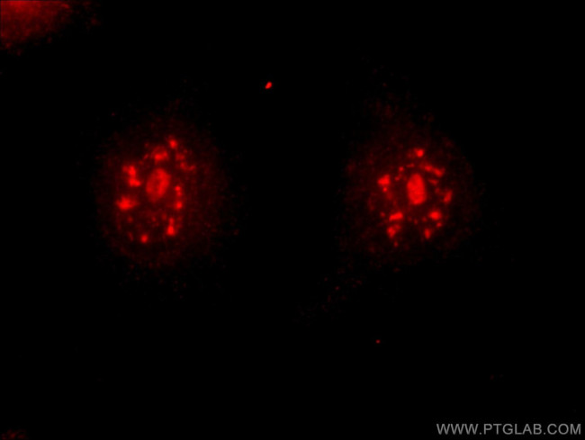 DMC1 Antibody in Immunocytochemistry (ICC/IF)