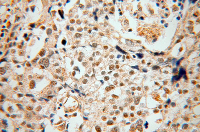 DMC1 Antibody in Immunohistochemistry (Paraffin) (IHC (P))