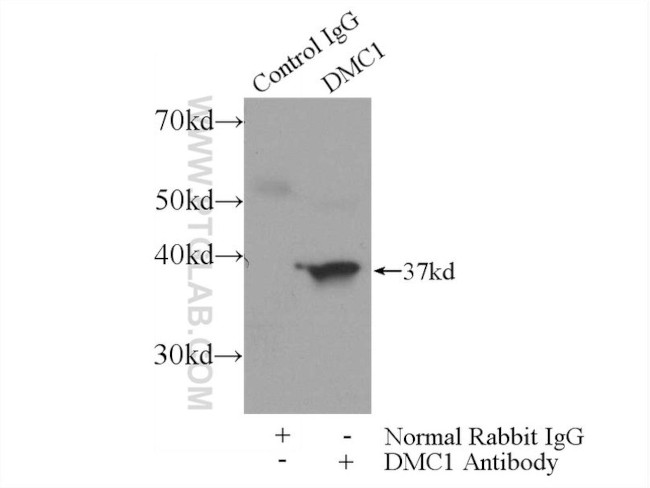 DMC1 Antibody in Immunoprecipitation (IP)