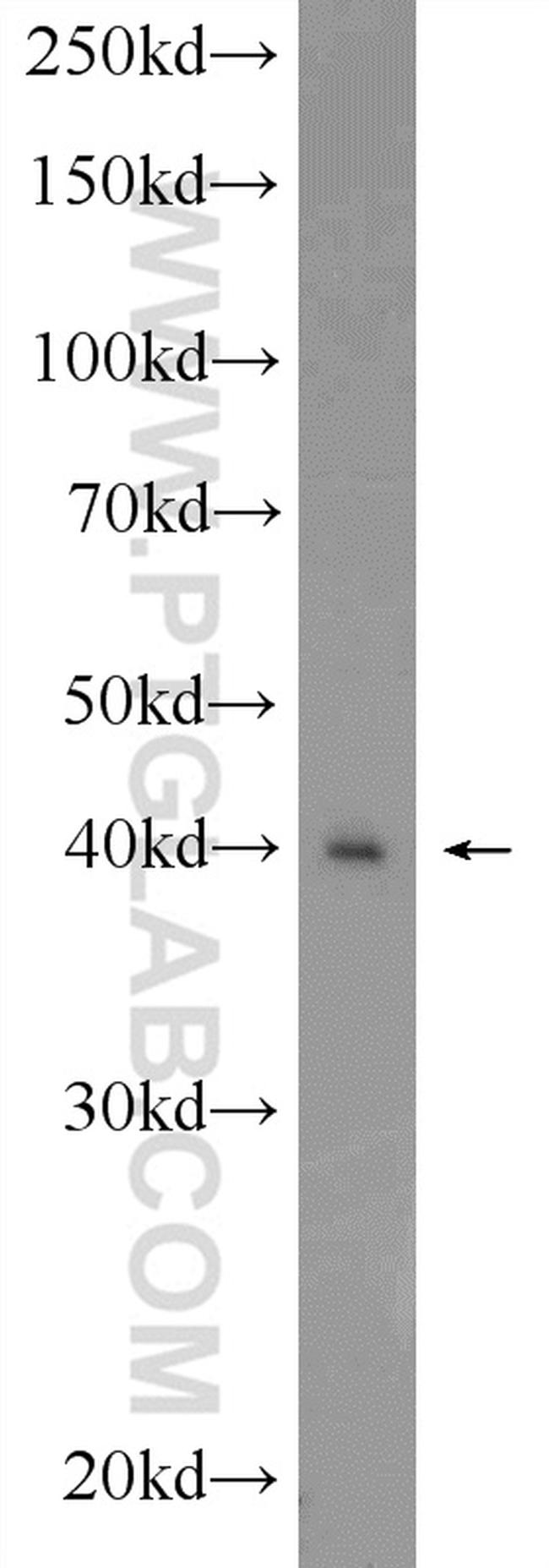 DMC1 Antibody in Western Blot (WB)