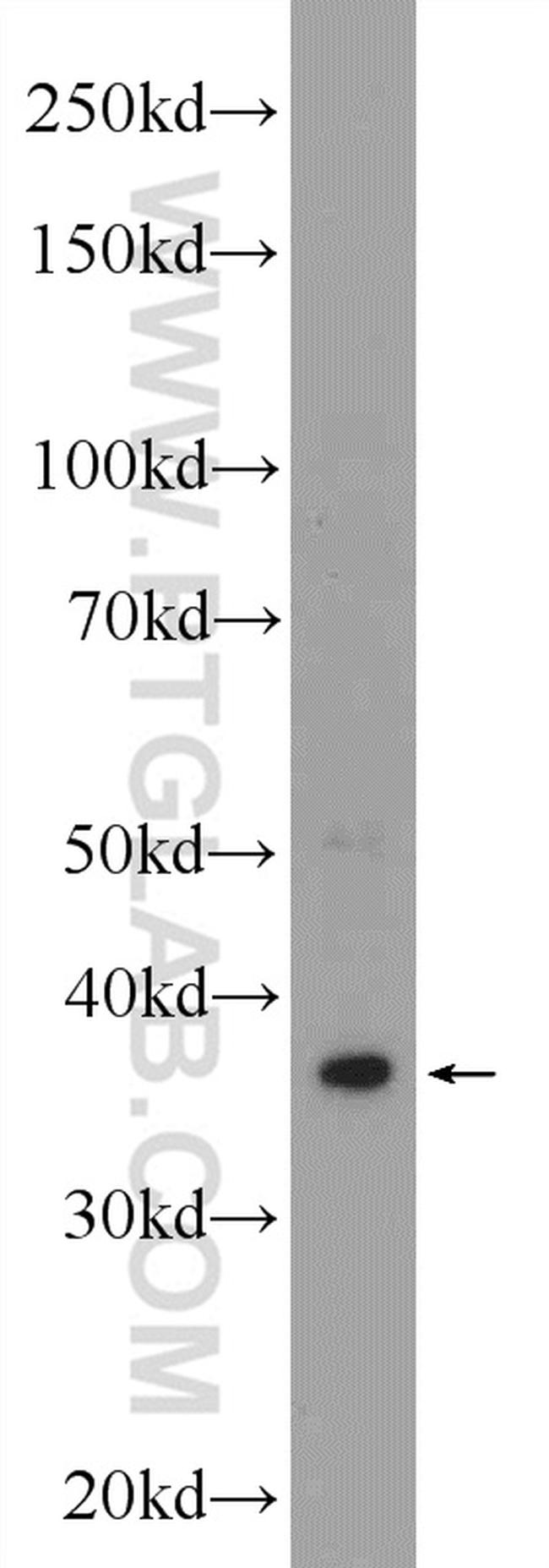 DMC1 Antibody in Western Blot (WB)