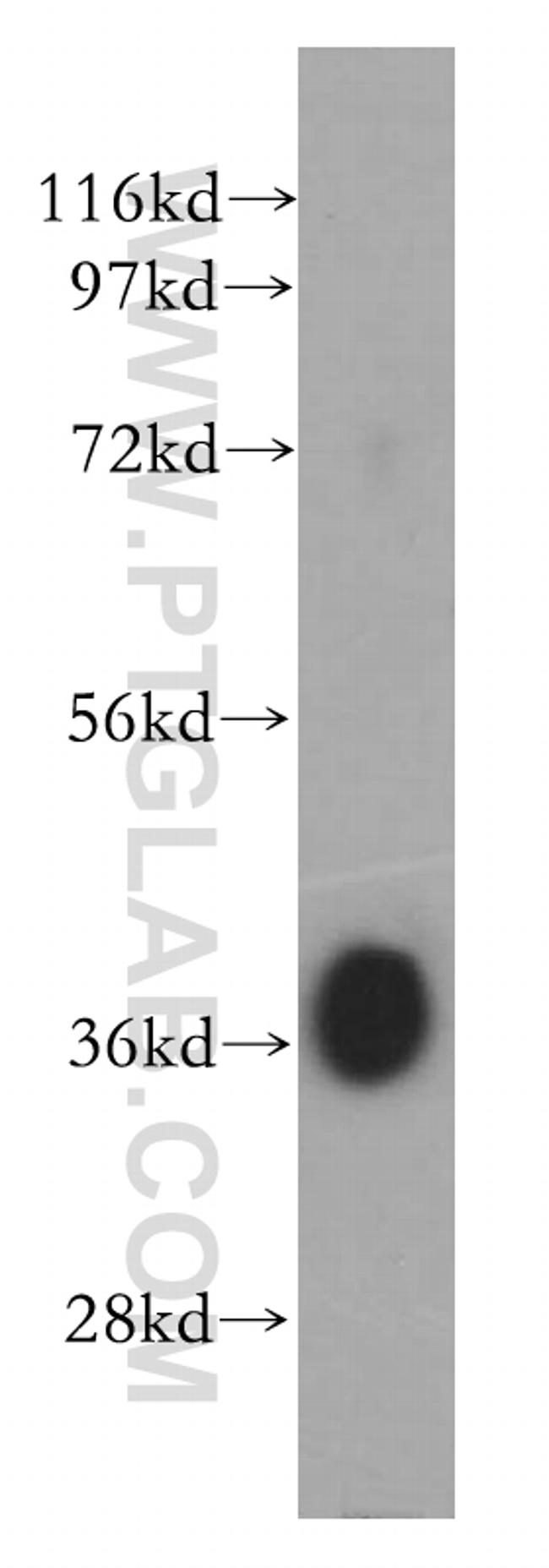 DMC1 Antibody in Western Blot (WB)