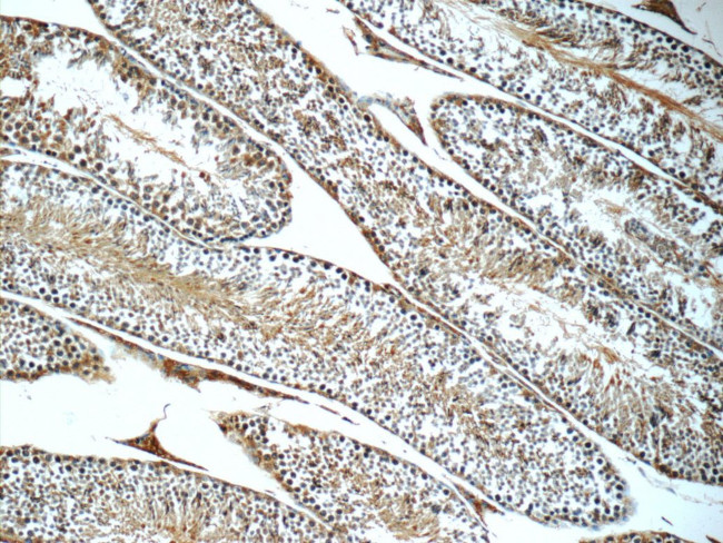 LSS Antibody in Immunohistochemistry (Paraffin) (IHC (P))