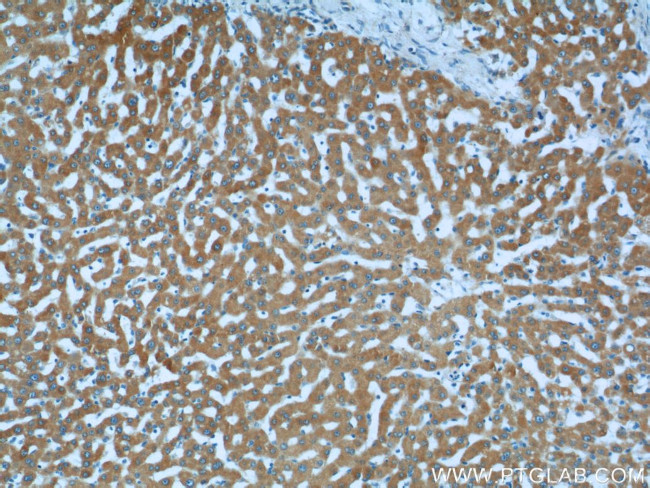 LSS Antibody in Immunohistochemistry (Paraffin) (IHC (P))