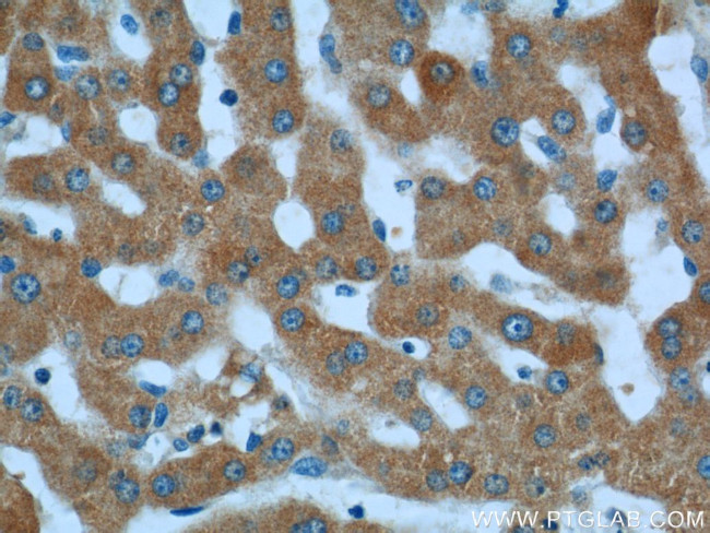 LSS Antibody in Immunohistochemistry (Paraffin) (IHC (P))