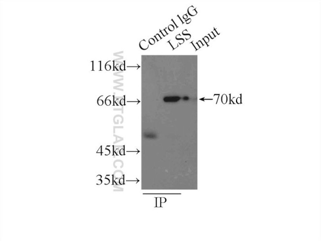 LSS Antibody in Immunoprecipitation (IP)