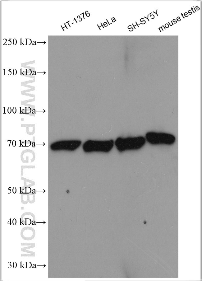 LSS Antibody in Western Blot (WB)