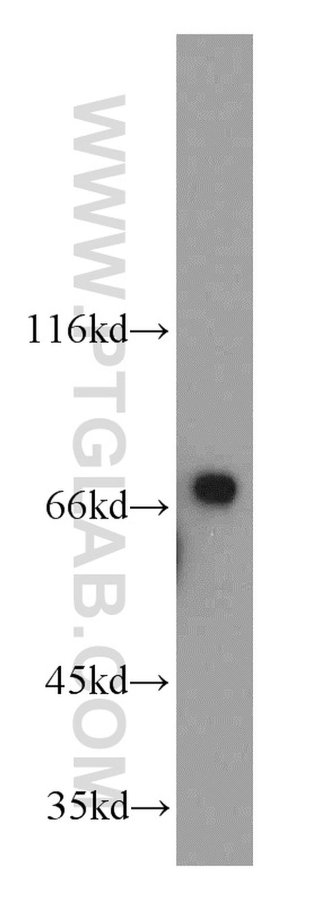 LSS Antibody in Western Blot (WB)