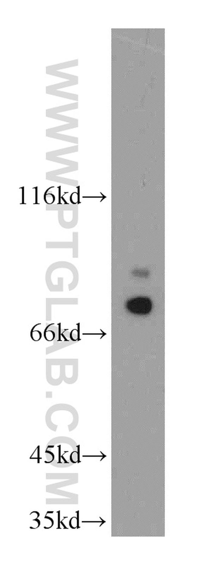 LSS Antibody in Western Blot (WB)