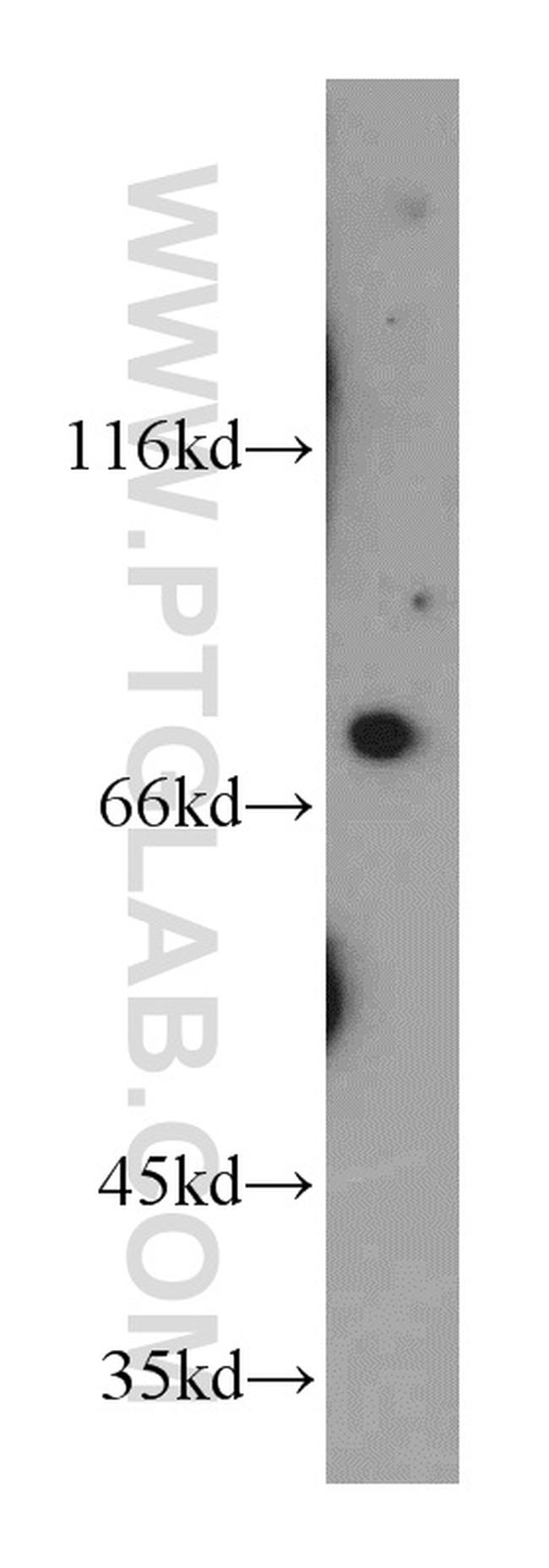 LSS Antibody in Western Blot (WB)