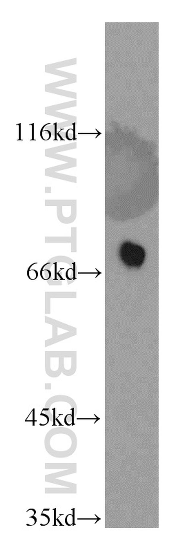 LSS Antibody in Western Blot (WB)