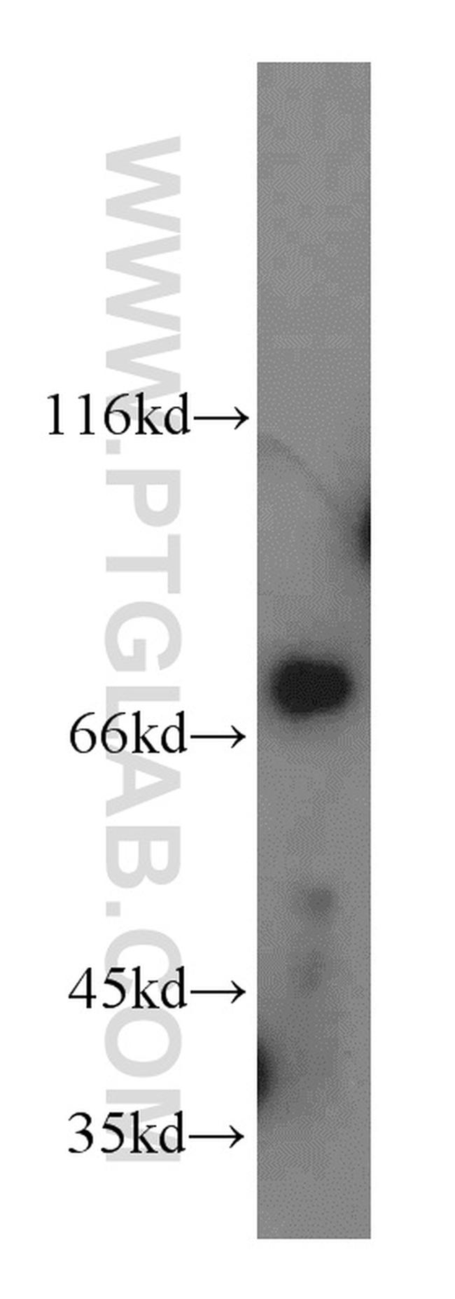 LSS Antibody in Western Blot (WB)