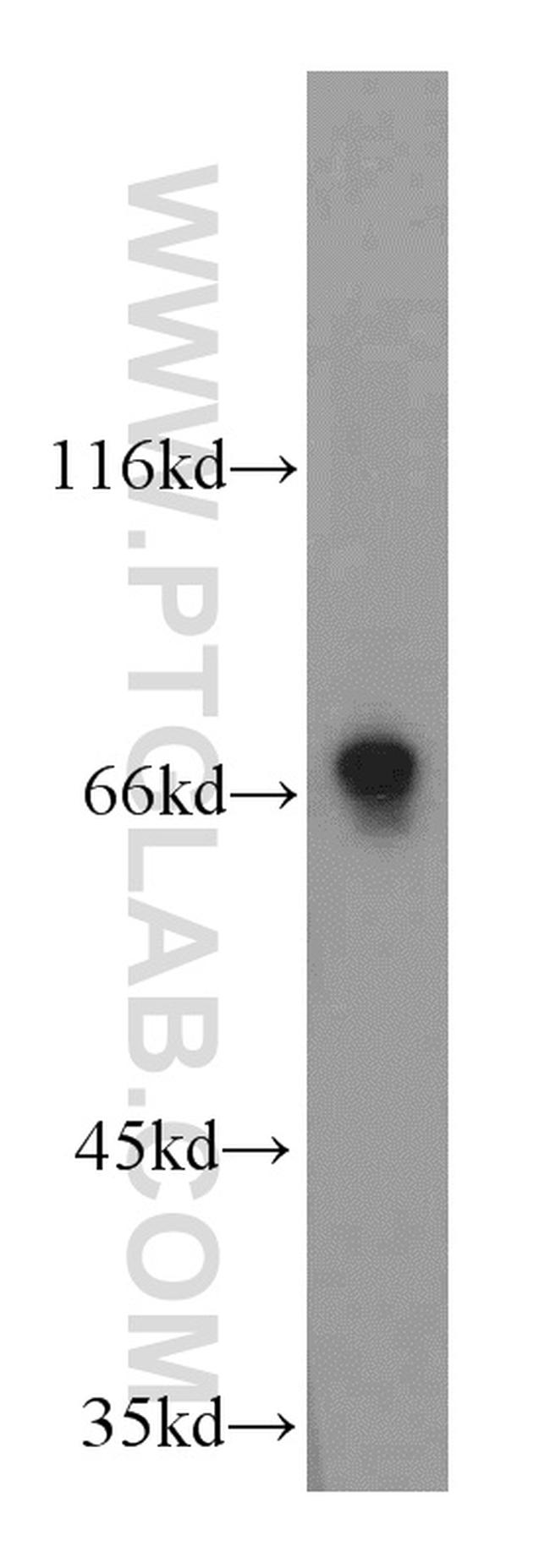 LSS Antibody in Western Blot (WB)