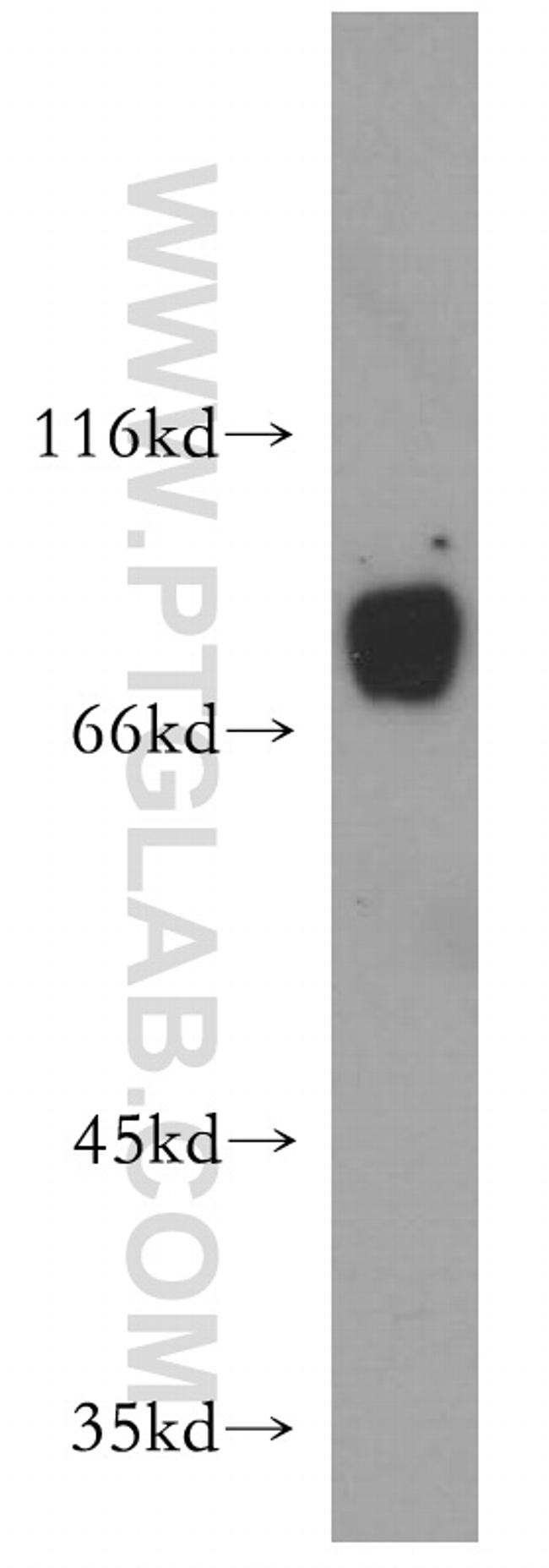 LSS Antibody in Western Blot (WB)