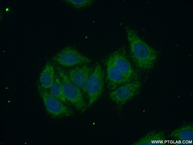 SLC9A9 Antibody in Immunocytochemistry (ICC/IF)