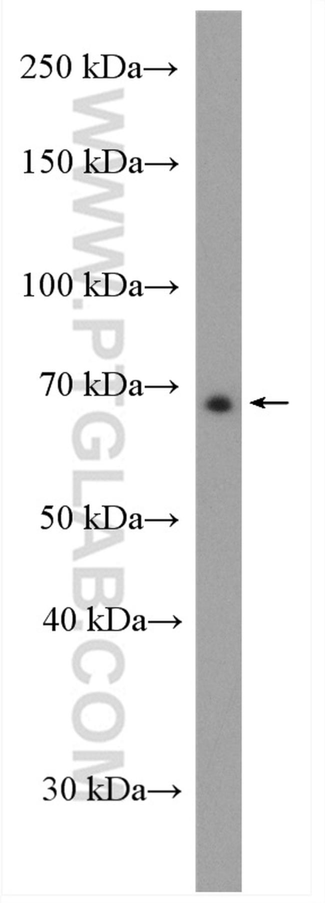 SLC9A9 Antibody in Western Blot (WB)