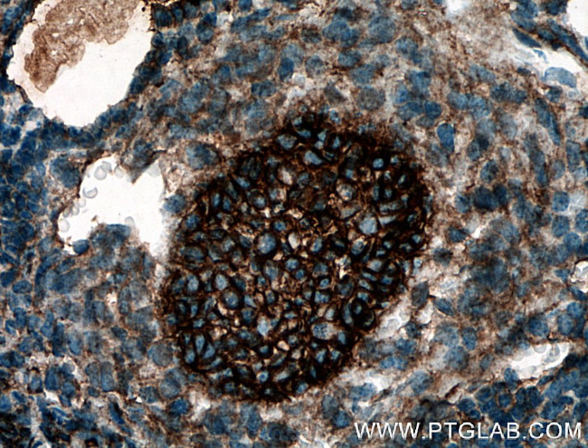 BOULE Antibody in Immunohistochemistry (Paraffin) (IHC (P))