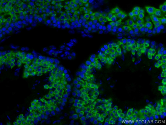 BOULE Antibody in Immunohistochemistry (PFA fixed) (IHC (PFA))