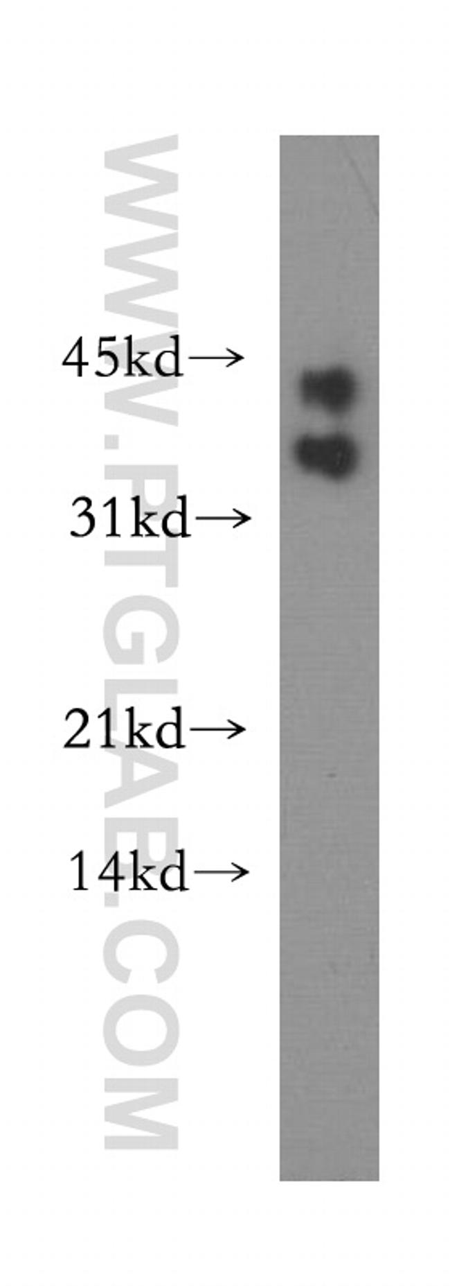 BOULE Antibody in Western Blot (WB)