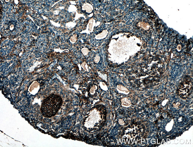 BOULE Antibody in Immunohistochemistry (Paraffin) (IHC (P))