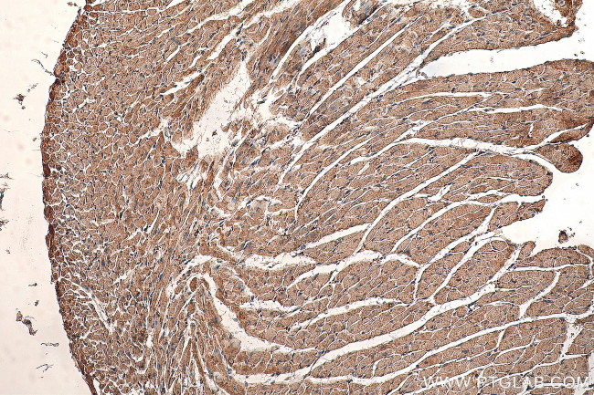 Phospholemman/FXYD1 Antibody in Immunohistochemistry (Paraffin) (IHC (P))