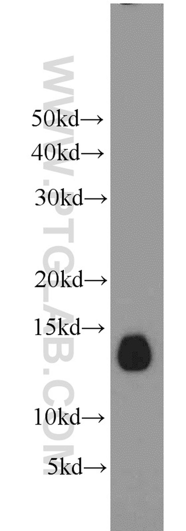 Phospholemman/FXYD1 Antibody in Western Blot (WB)